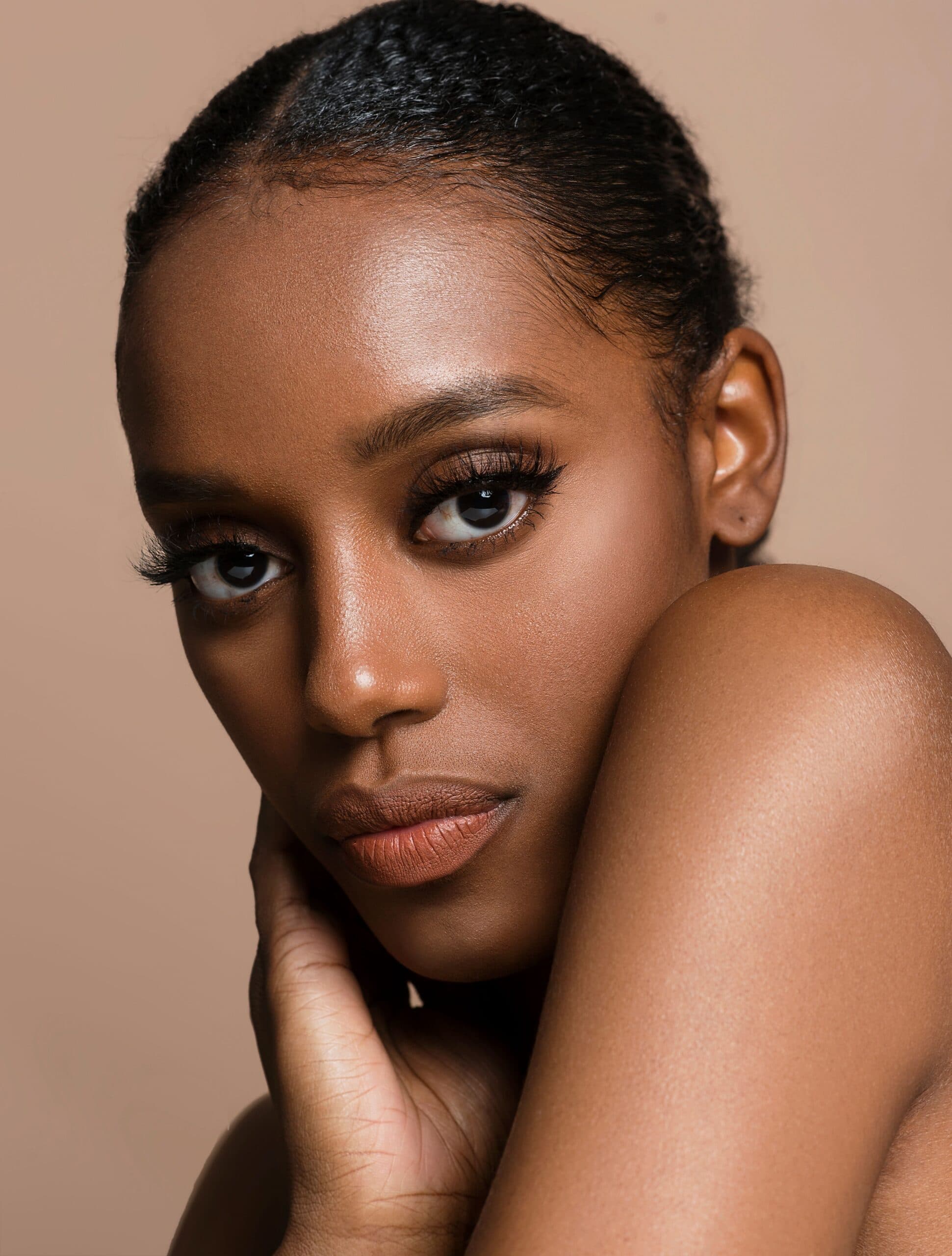 RF Microneedling in Darker Skin girl